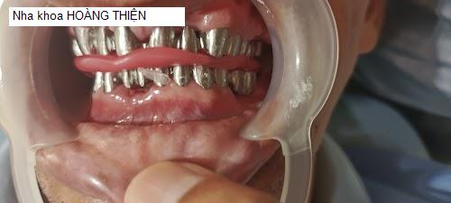 Yến Sào Bình Thuận - Gợi ý 14 Nha Khoa tốt nhất khu vực Huyện Tánh Linh